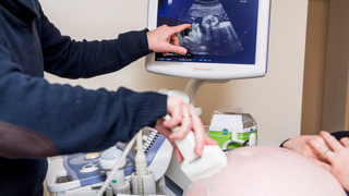 Pregnancy Is Absolutely a Life-Threatening Condition